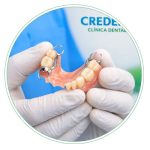 Prótesis dental de metal cromocobalto con garantía extendida