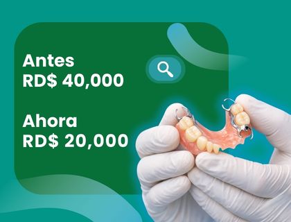 Oferta prótesis dentales 50% descuento en Santiago de los Caballeros - Zenithe Clínica Dental